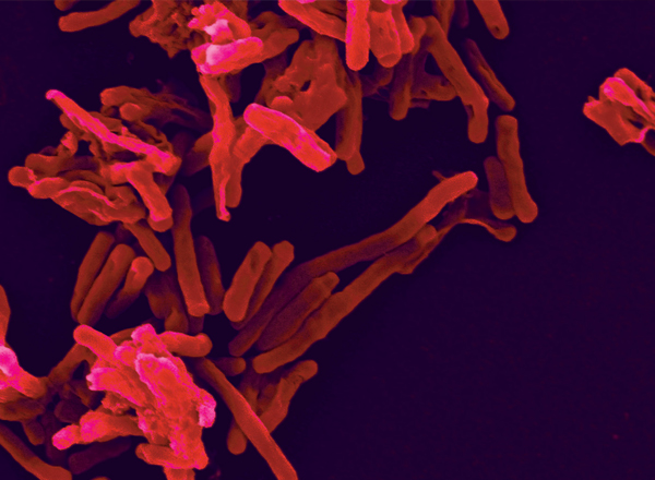 ISB Researchers Identify New Protein Modification Critical to TB Pathogen Growth