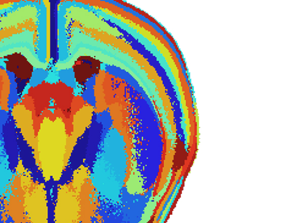 ISB Study Finds Molecular Link Between Simulated PTSD & Physical Heart Damage