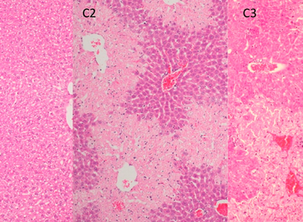 New Study Identifies Organ-Specific Biomarkers for Acute Liver Injury