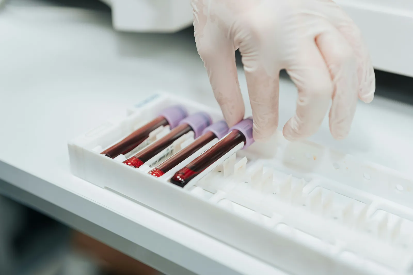 blood samples