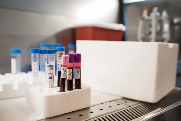 vials of blood on a bench in the lab