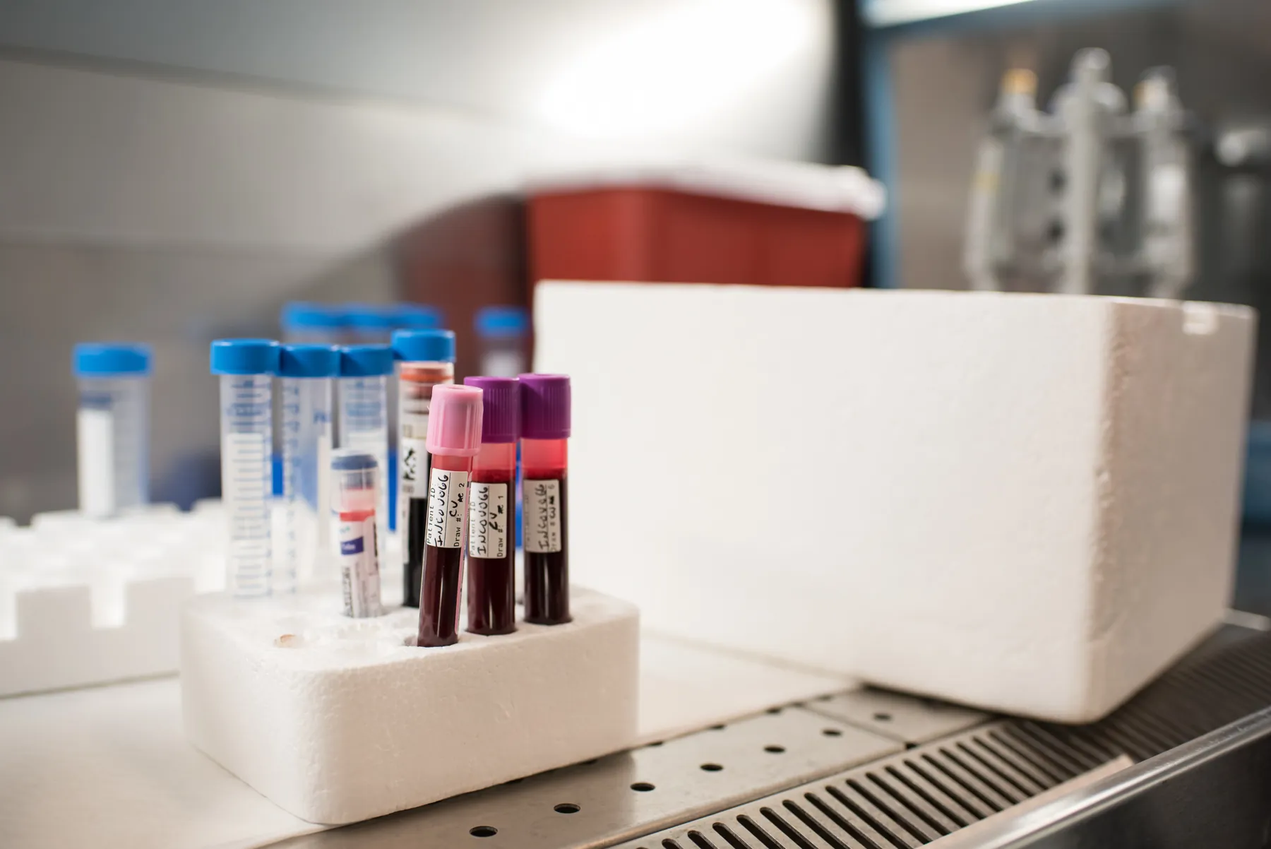 vials of blood on a bench in the lab
