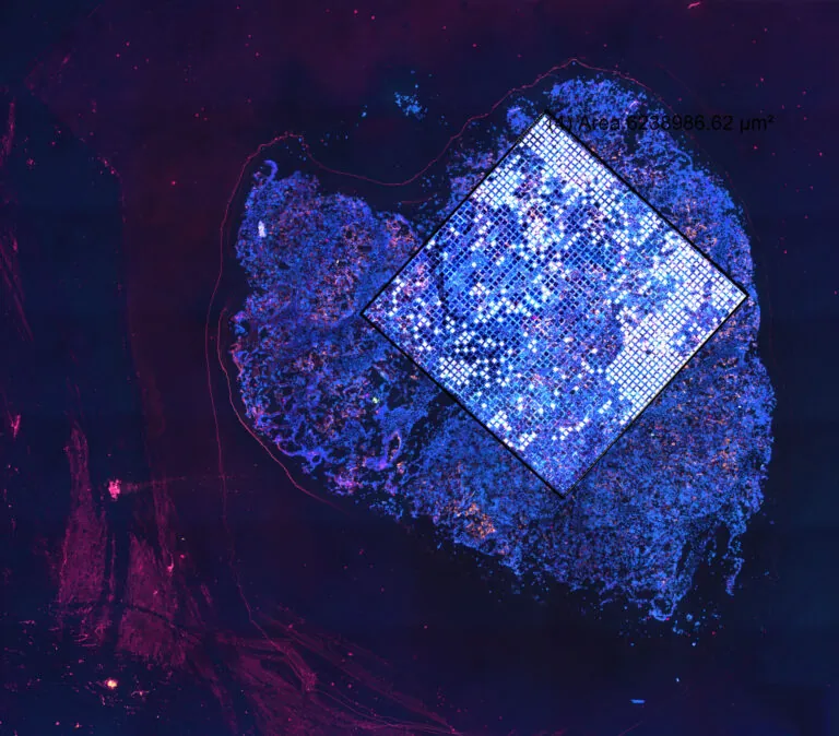 cancer graphic