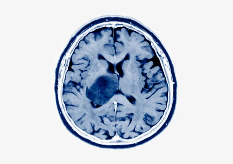a brain graphic
