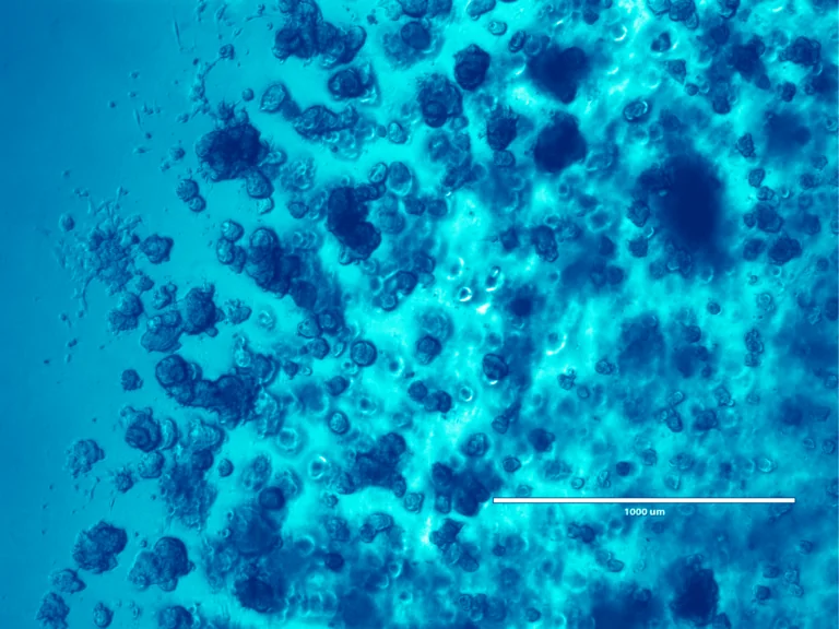 organoid