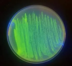 GF ecoli