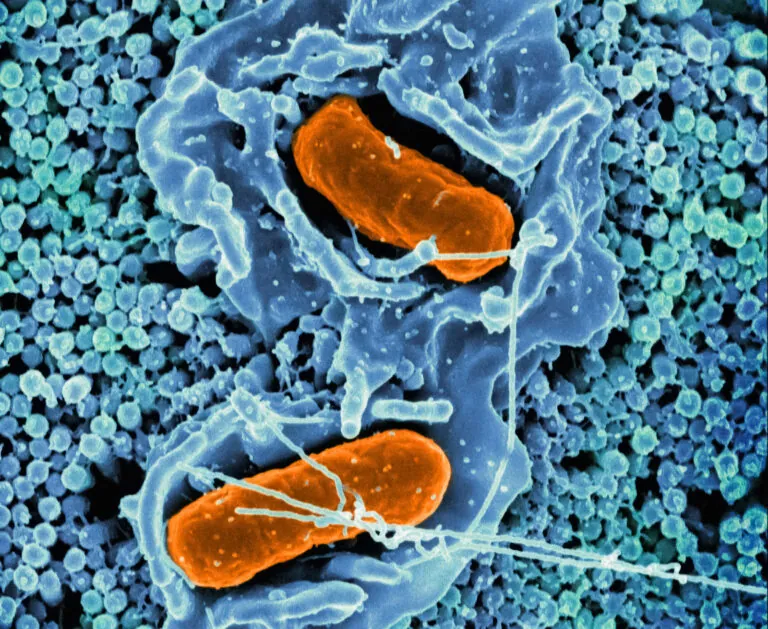 national institute of allergy and infectious diseases